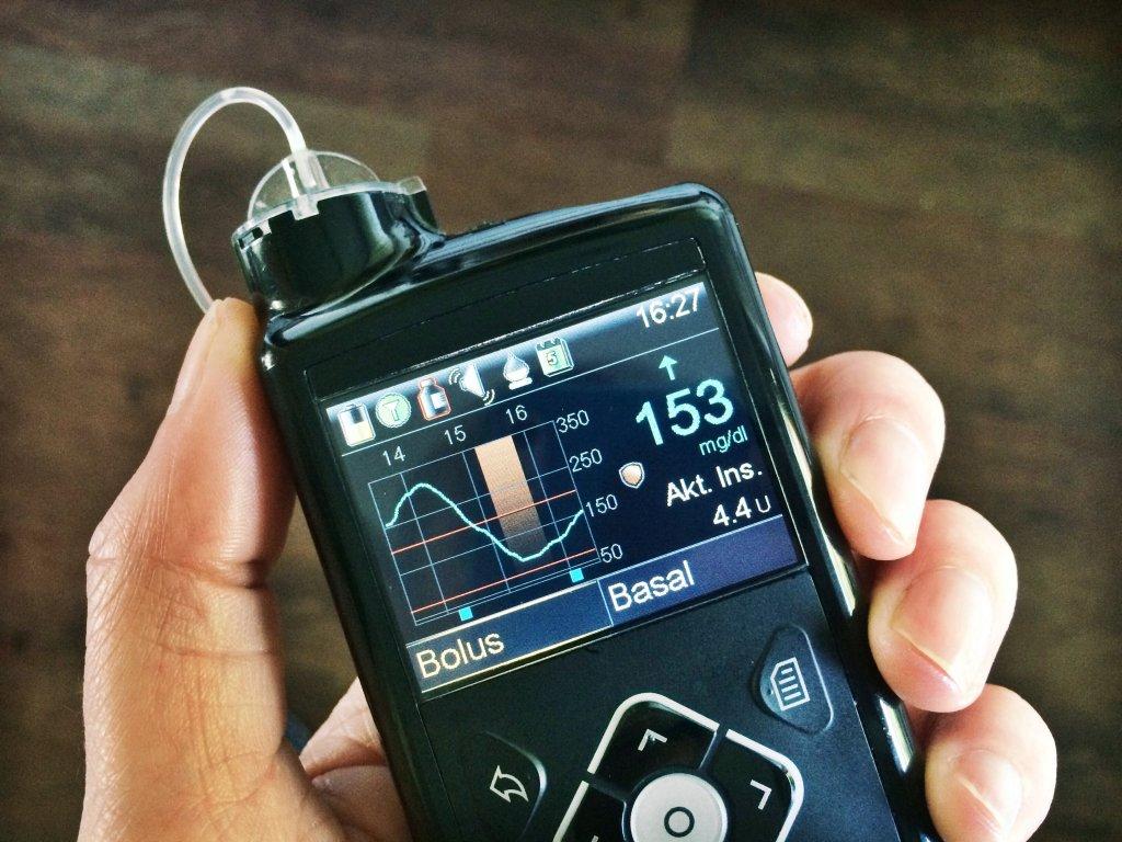 Medtronic CGM system